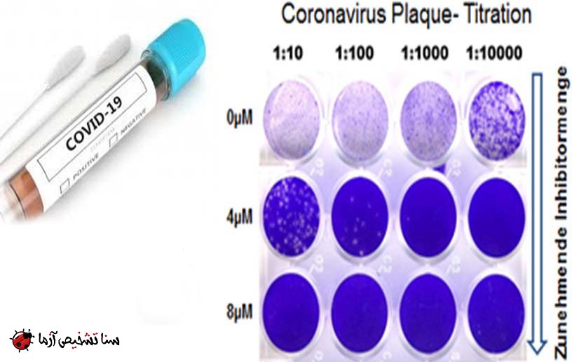 تشخیص آزمایشگاهی کرونا ویروس جدید